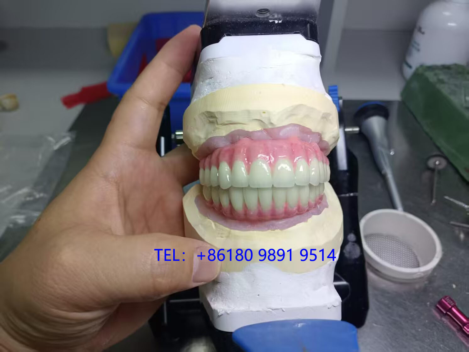 深圳Myy义齿国际出口专业牙科诊所合作厂家